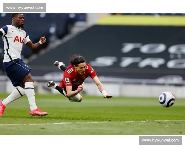 卡瓦尼小腿伤缺战拜仁 博卡锋线核心缺席关键战役